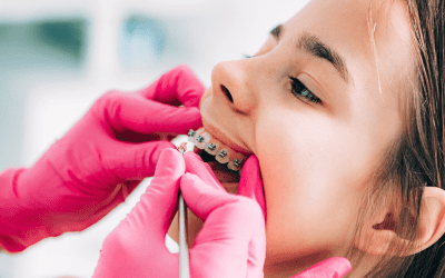 Tips for Maintaining Healthy Teeth During Treatment